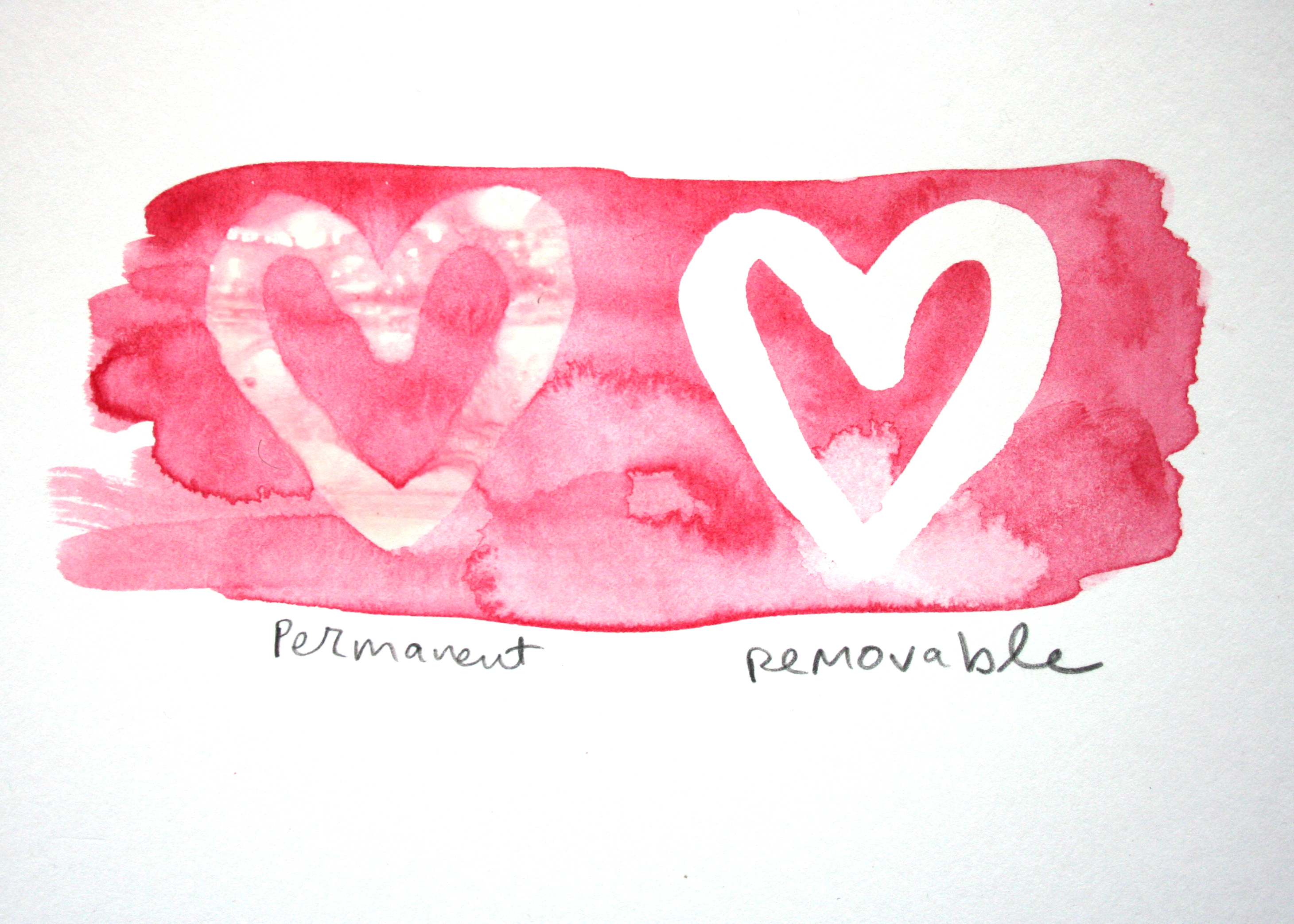 Permanent versus removable