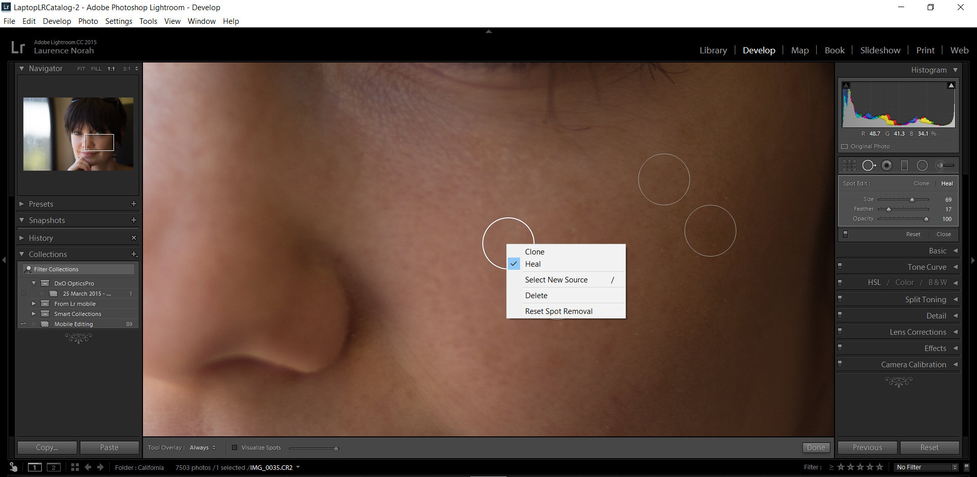 Fix lightroom skin blemish image 10