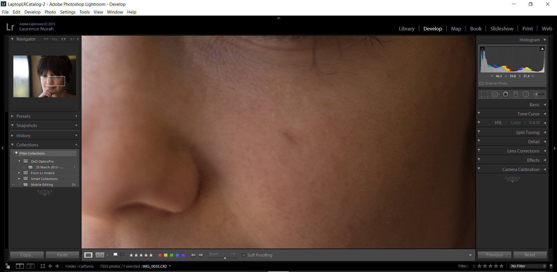 Zoom in to blemish