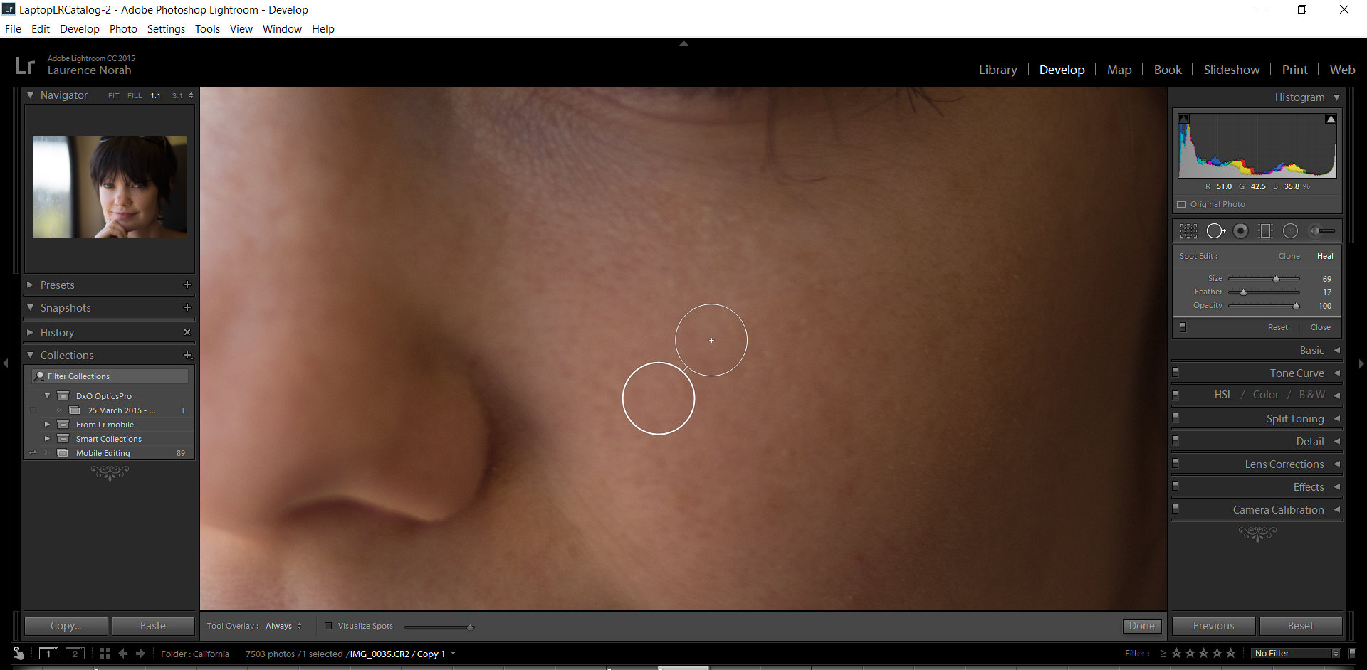 Lightroom Correcting Skin Blemishes