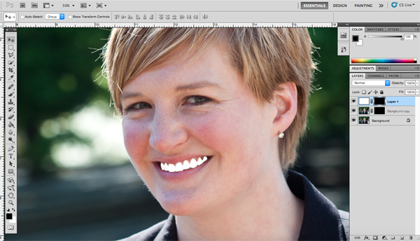 Teeth Whiten Fill