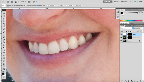 Teeth Whiten Mask3